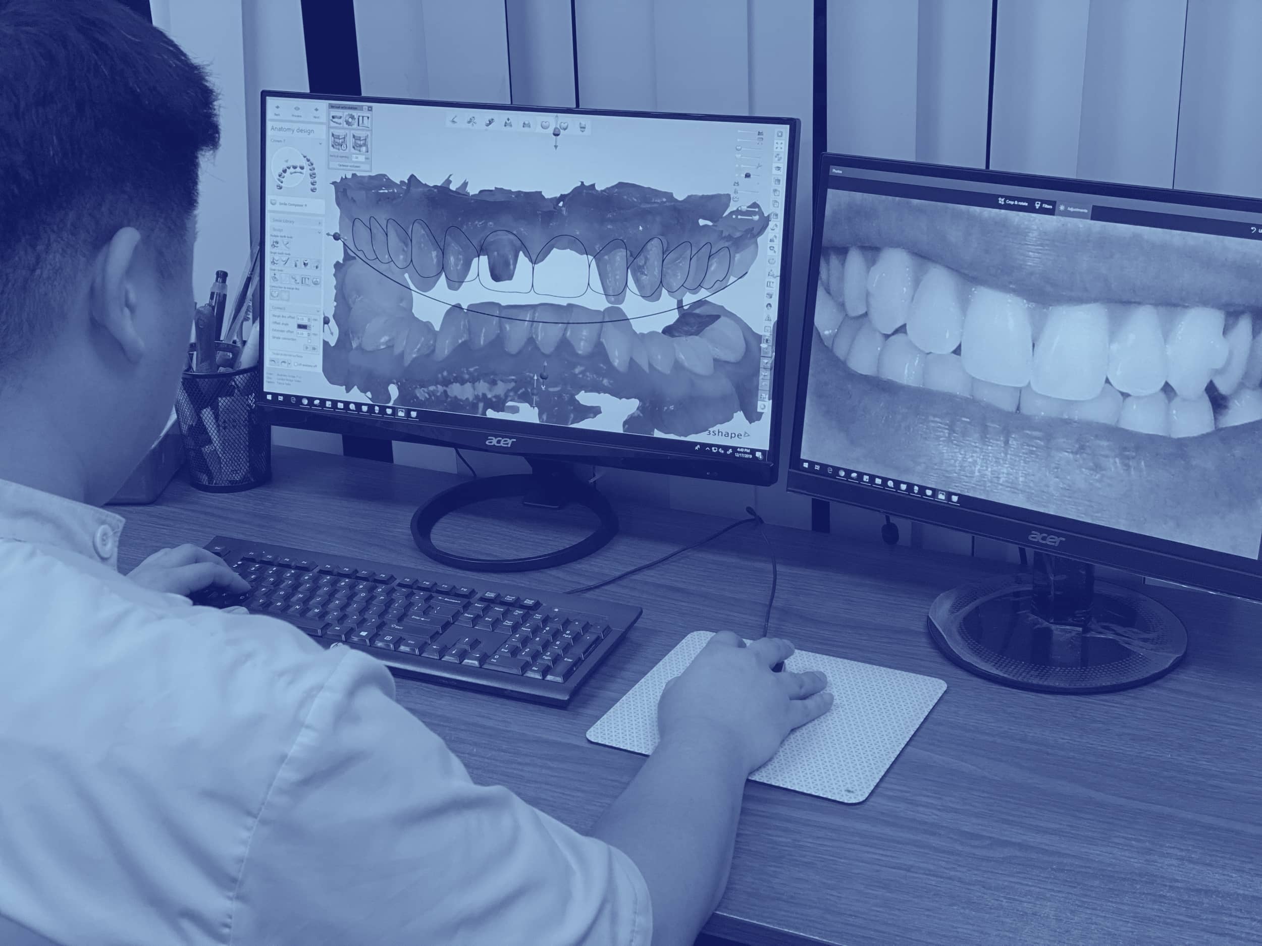 The Importance of Smile Design