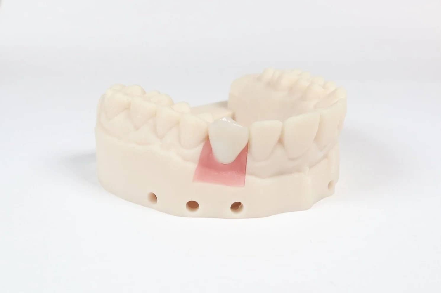 The Easiest Way to Protect Implants